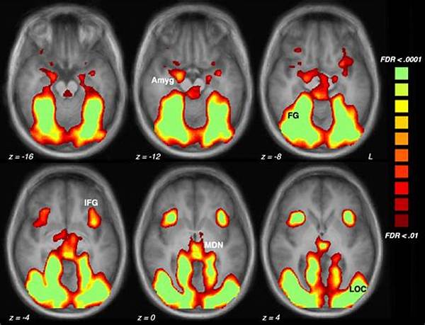 Neuroimaging Studies On Addiction